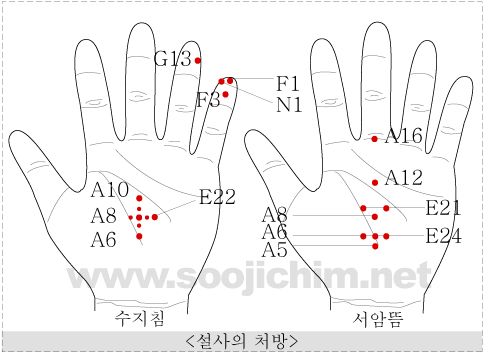 뜸 이미지